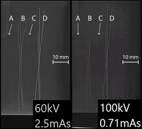 radiopacity comparisons between round wire and ribbon of varying compositions